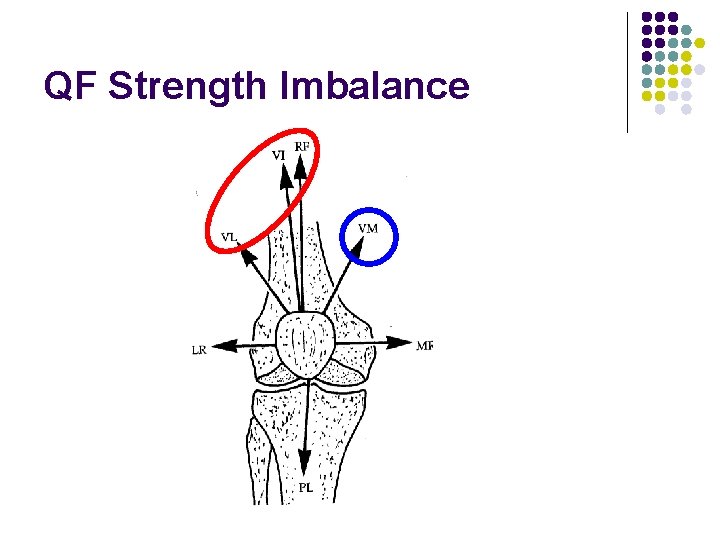 QF Strength Imbalance 