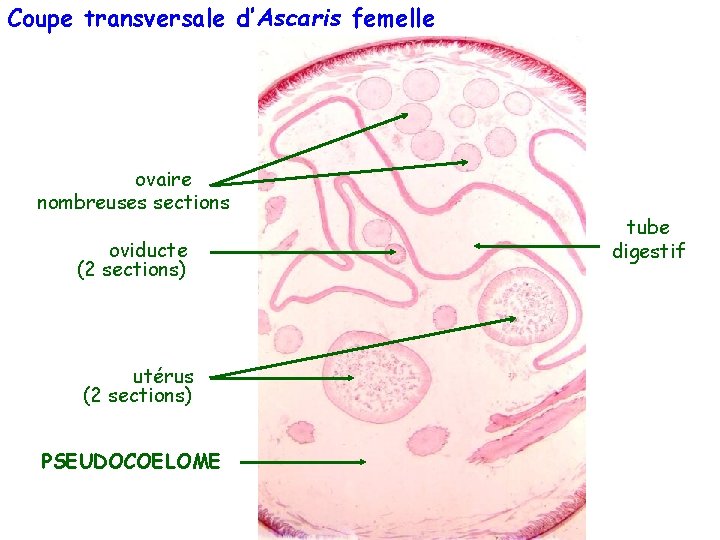 Coupe transversale d’Ascaris femelle ovaire nombreuses sections oviducte (2 sections) utérus (2 sections) PSEUDOCOELOME