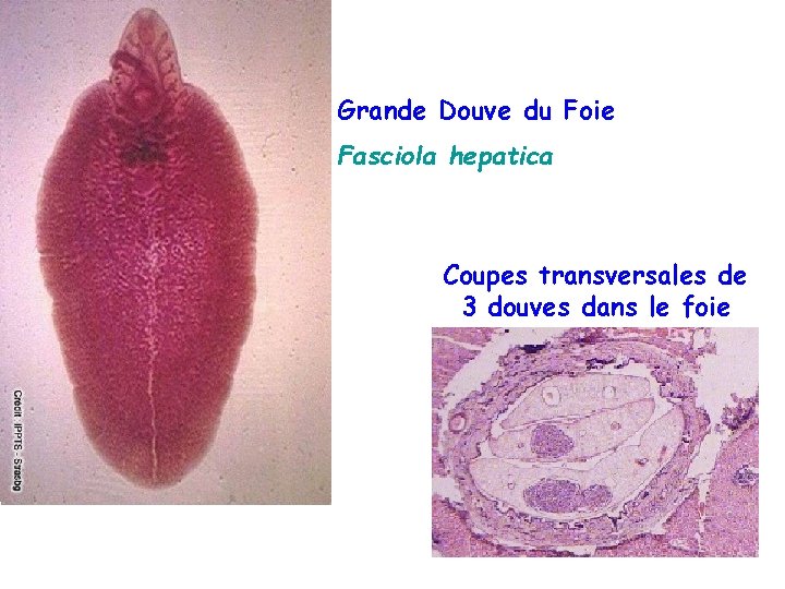 Grande Douve du Foie Fasciola hepatica Coupes transversales de 3 douves dans le foie
