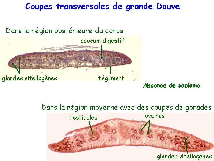 Coupes transversales de grande Douve Dans la région postérieure du corps coecum digestif glandes