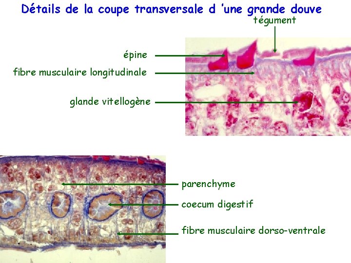 Détails de la coupe transversale d ’une grande douve tégument épine fibre musculaire longitudinale