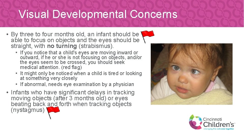 Visual Developmental Concerns • By three to four months old, an infant should be
