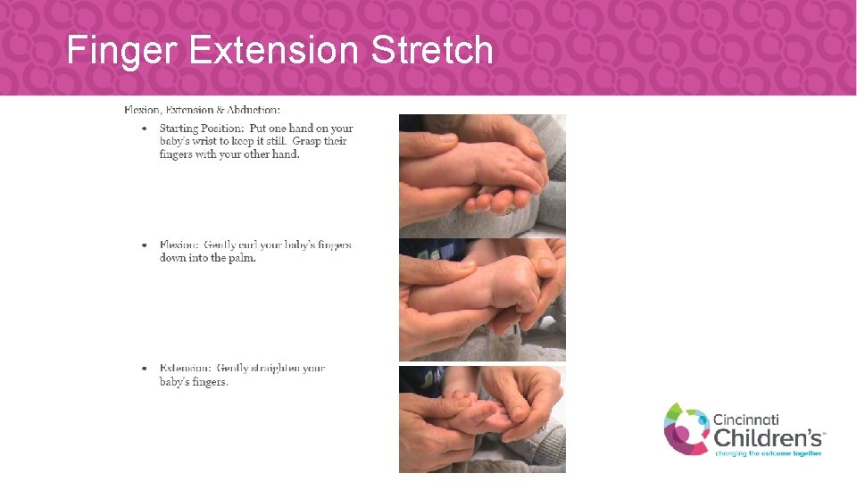 Finger Extension Stretch 