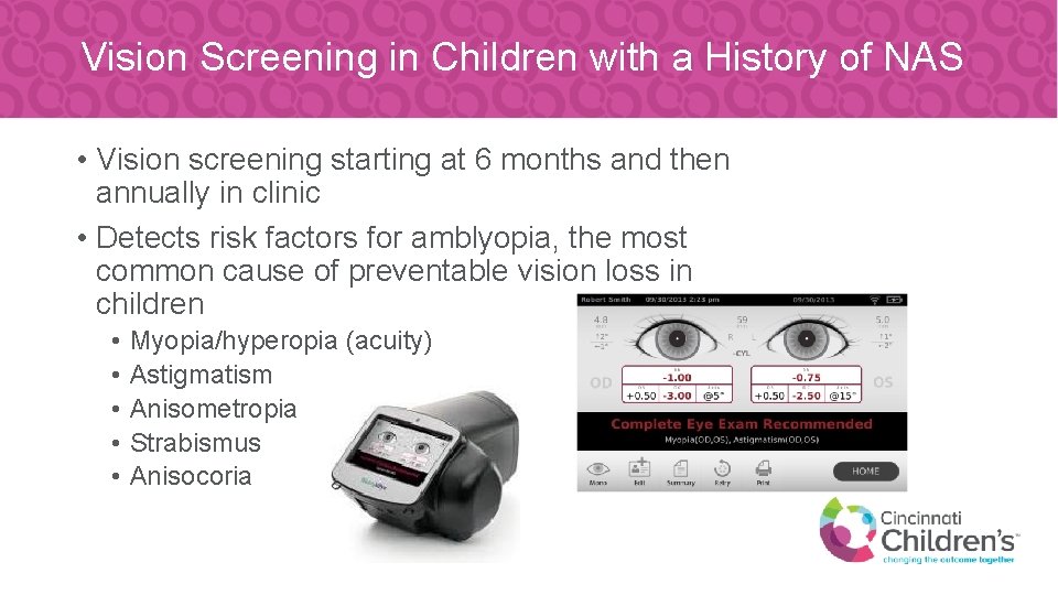 Vision Screening in Children with a History of NAS • Vision screening starting at