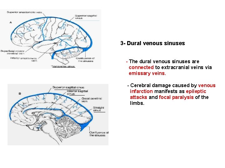 3 - Dural venous sinuses - The dural venous sinuses are connected to extracranial