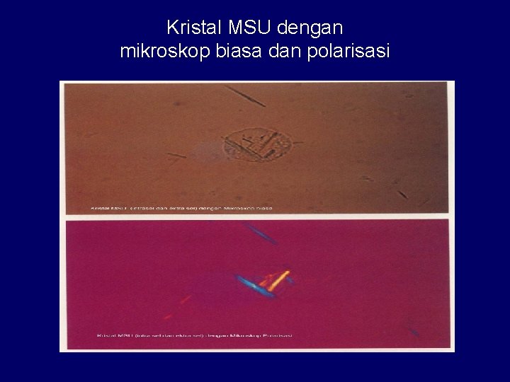 Kristal MSU dengan mikroskop biasa dan polarisasi 