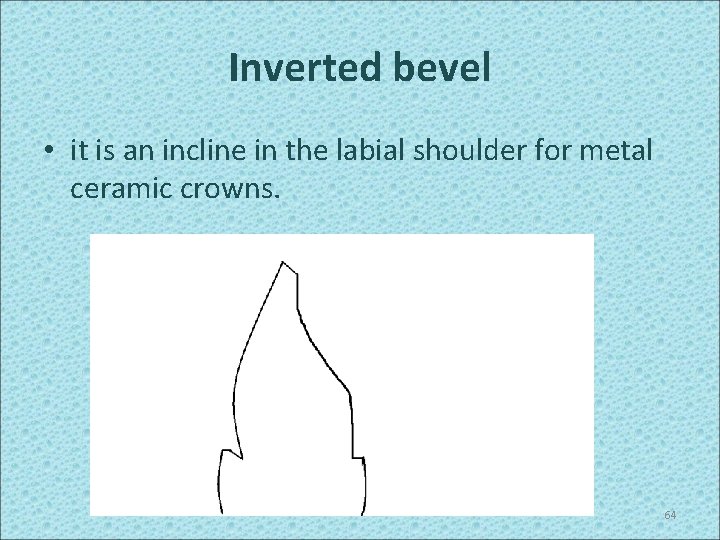 Inverted bevel • it is an incline in the labial shoulder for metal ceramic