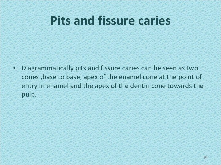 Pits and fissure caries • Diagrammatically pits and fissure caries can be seen as