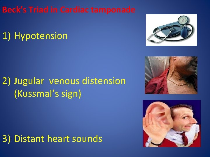 Beck’s Triad in Cardiac tamponade 1) Hypotension 2) Jugular venous distension (Kussmal’s sign) 3)