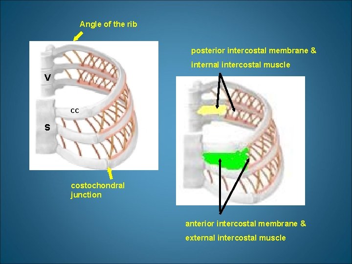 Angle of the rib posterior intercostal membrane & internal intercostal muscle V CC S