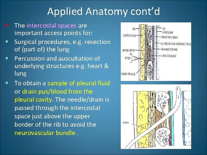 Applied Anatomy cont’d § The intercostal spaces are important access points for: § Surgical