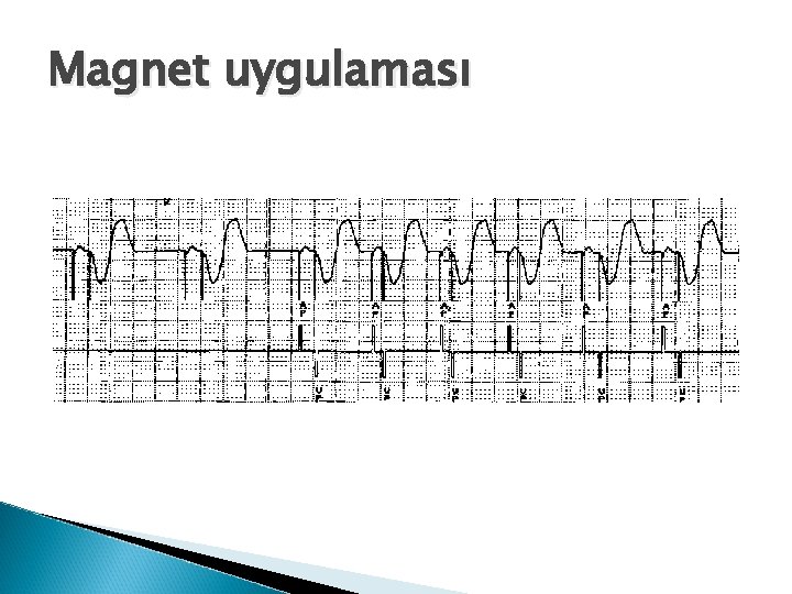 Magnet uygulaması 