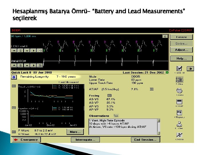 Hesaplanmış Batarya Ömrü- “Battery and Lead Measurements” seçilerek 