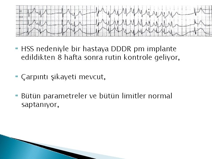  HSS nedeniyle bir hastaya DDDR pm implante edildikten 8 hafta sonra rutin kontrole