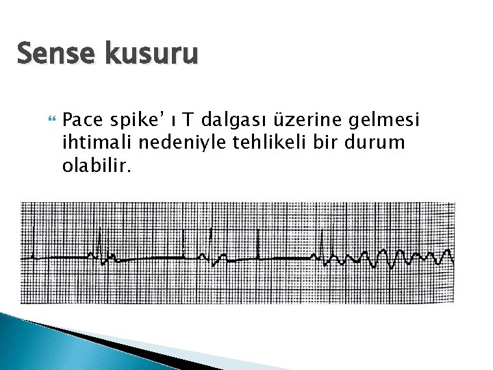 Sense kusuru Pace spike’ ı T dalgası üzerine gelmesi ihtimali nedeniyle tehlikeli bir durum