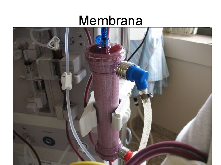 Membrana 