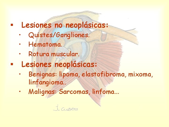 Lesiones no neoplásicas: § • • • Quistes/Gangliones. Hematoma. Rotura muscular. Lesiones neoplásicas: §