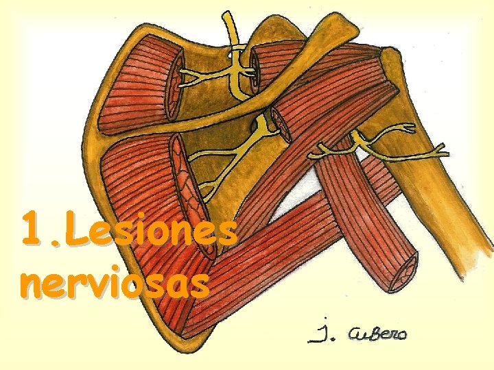 1. Lesiones nerviosas 