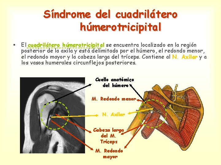 Síndrome del cuadrilátero húmerotricipital § El cuadrilátero húmerotricipital se encuentra localizado en la región