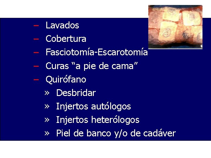 – – – Lavados Cobertura Fasciotomía-Escarotomía Curas “a pie de cama” Quirófano » Desbridar