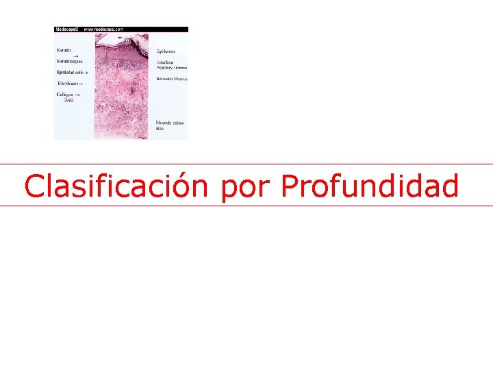 Clasificación por Profundidad 