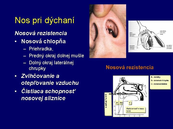 Nos pri dýchaní Nosová rezistencia • Nosová chlopňa – Priehradka, – Predný okraj dolnej