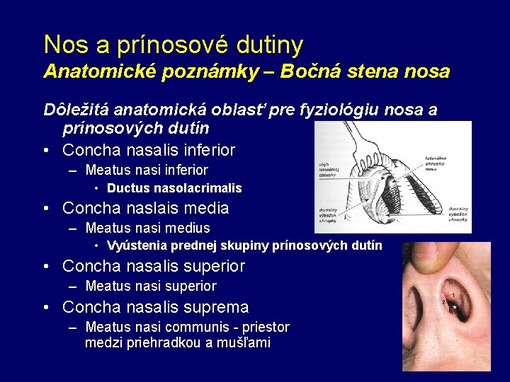 Nos a prínosové dutiny Anatomické poznámky – Bočná stena nosa Dôležitá anatomická oblasť pre