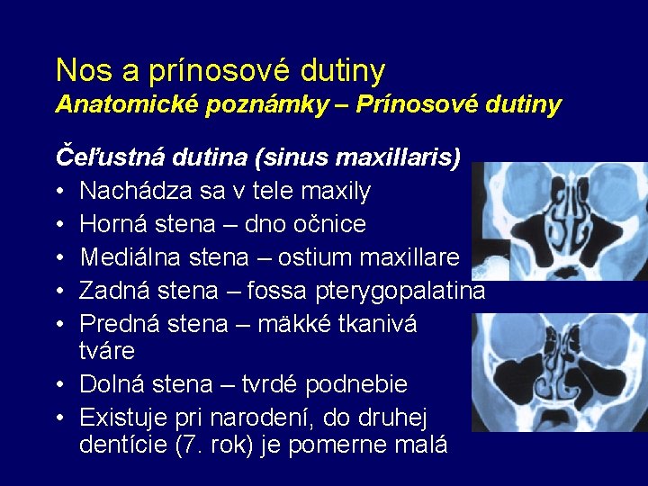 Nos a prínosové dutiny Anatomické poznámky – Prínosové dutiny Čeľustná dutina (sinus maxillaris) •