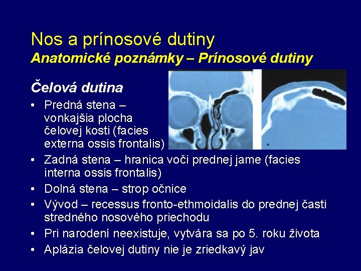 Nos a prínosové dutiny Anatomické poznámky – Prínosové dutiny Čelová dutina • Predná stena