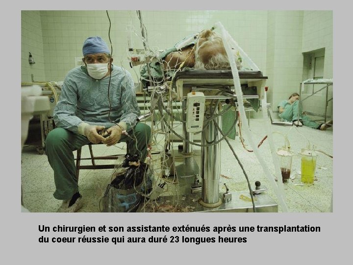 Un chirurgien et son assistante exténués après une transplantation du coeur réussie qui aura