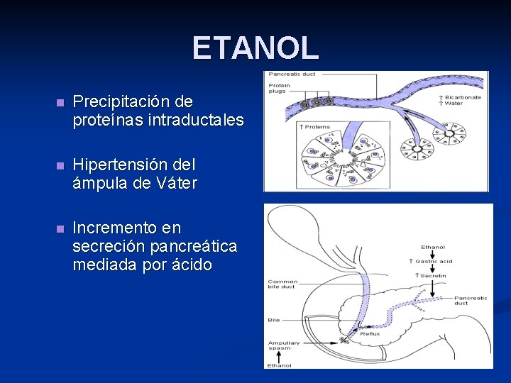 ETANOL n Precipitación de proteínas intraductales n Hipertensión del ámpula de Váter n Incremento