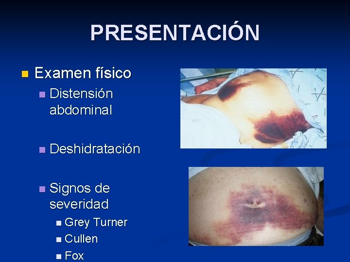 PRESENTACIÓN n Examen físico n Distensión abdominal n Deshidratación n Signos de severidad n