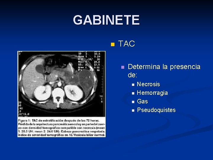 GABINETE n TAC n Determina la presencia de: n n Necrosis Hemorragia Gas Pseudoquistes