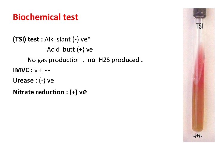 Biochemical test (TSI) test : Alk slant (-) ve* Acid butt (+) ve No