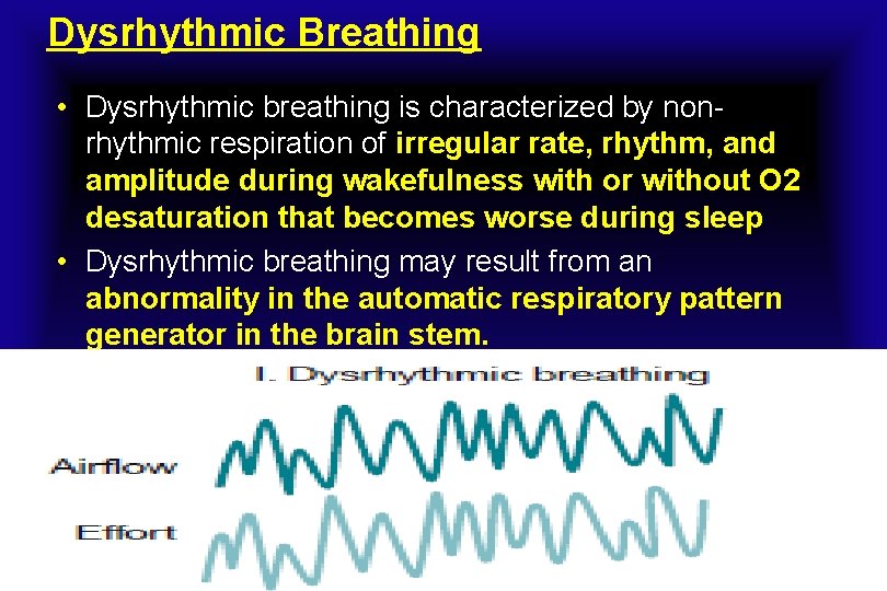 Dysrhythmic Breathing • Dysrhythmic breathing is characterized by nonrhythmic respiration of irregular rate, rhythm,