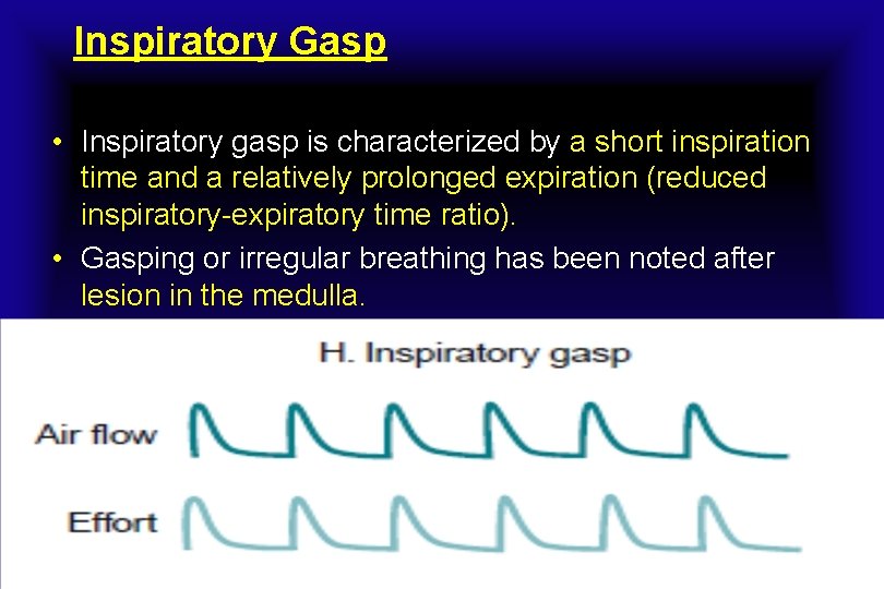 Inspiratory Gasp • Inspiratory gasp is characterized by a short inspiration time and a