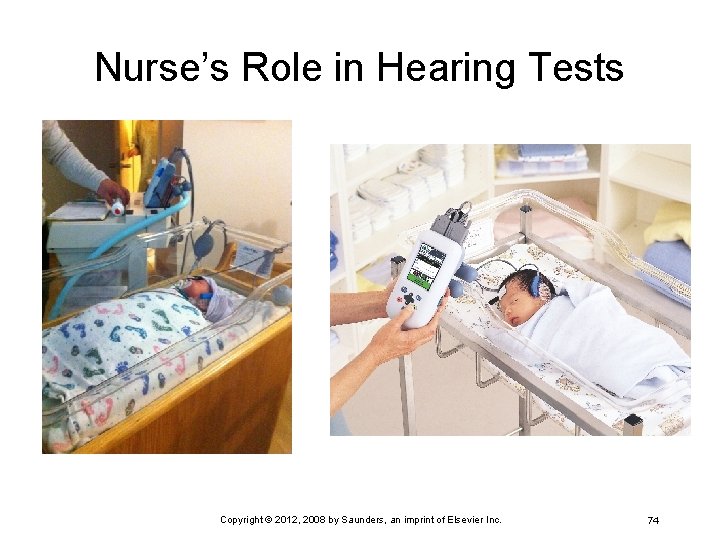 Nurse’s Role in Hearing Tests Copyright © 2012, 2008 by Saunders, an imprint of