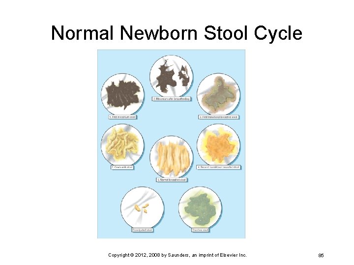 Normal Newborn Stool Cycle Copyright © 2012, 2008 by Saunders, an imprint of Elsevier