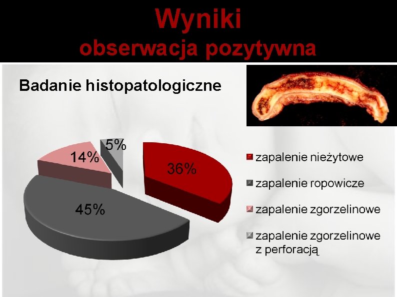 Wyniki obserwacja pozytywna Badanie histopatologiczne 