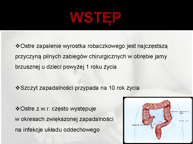 WSTĘP v. Ostre zapalenie wyrostka robaczkowego jest najczęstszą przyczyną pilnych zabiegów chirurgicznych w obrębie