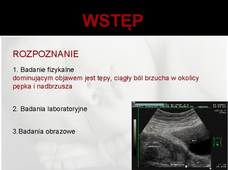 WSTĘP ROZPOZNANIE 1. Badanie fizykalne dominującym objawem jest tępy, ciągły ból brzucha w okolicy