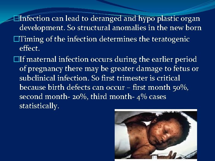 �Infection can lead to deranged and hypo plastic organ development. So structural anomalies in