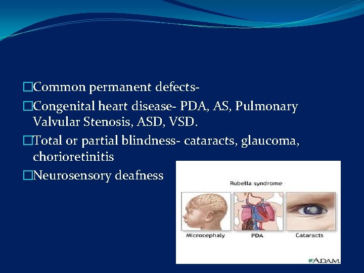�Common permanent defects- �Congenital heart disease- PDA, AS, Pulmonary Valvular Stenosis, ASD, VSD. �Total