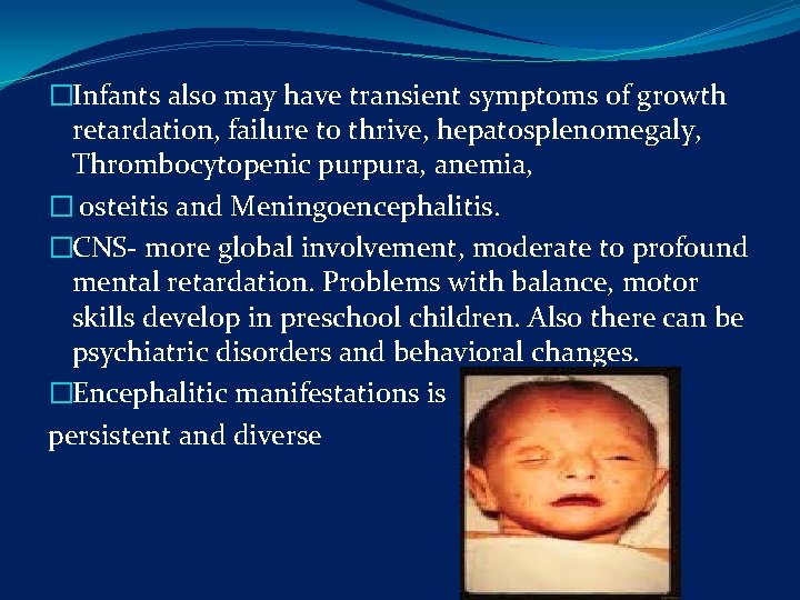 �Infants also may have transient symptoms of growth retardation, failure to thrive, hepatosplenomegaly, Thrombocytopenic