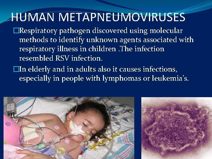 HUMAN METAPNEUMOVIRUSES �Respiratory pathogen discovered using molecular methods to identify unknown agents associated with