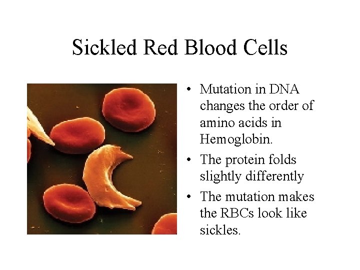 Sickled Red Blood Cells • Mutation in DNA changes the order of amino acids