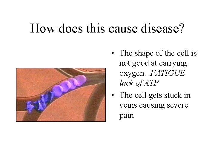 How does this cause disease? • The shape of the cell is not good