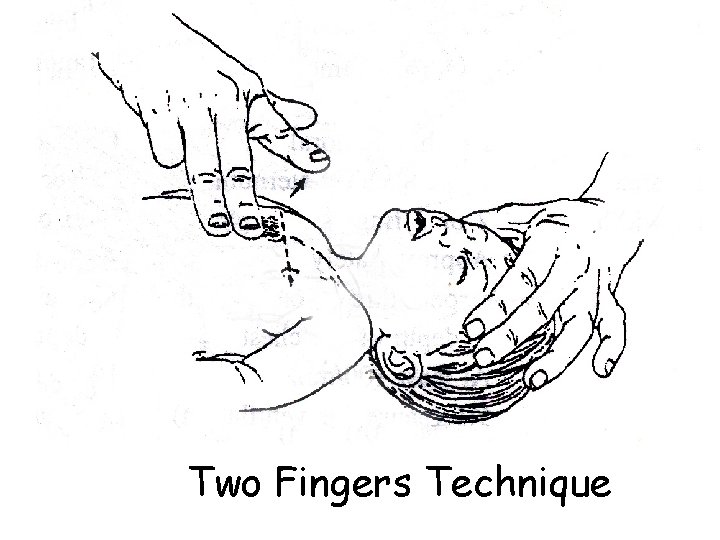 Two Fingers Technique 