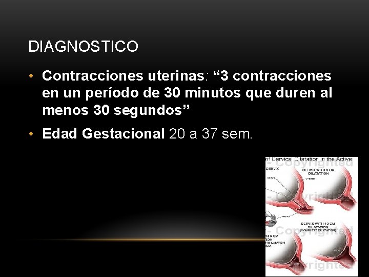DIAGNOSTICO • Contracciones uterinas: “ 3 contracciones en un período de 30 minutos que