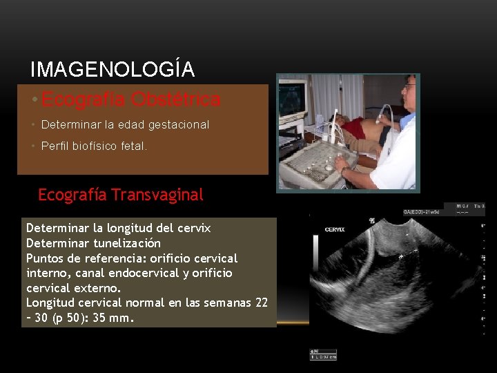 IMAGENOLOGÍA • Ecografía Obstétrica • Determinar la edad gestacional • Perfil biofísico fetal. Ecografía